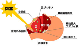 原因について